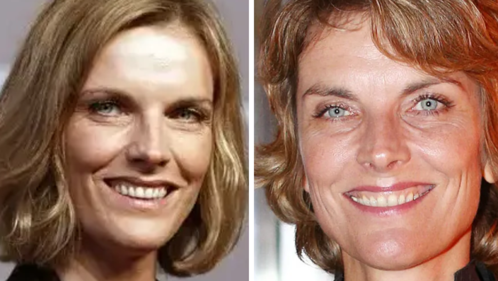 Marietta Slomka Brustkrebs